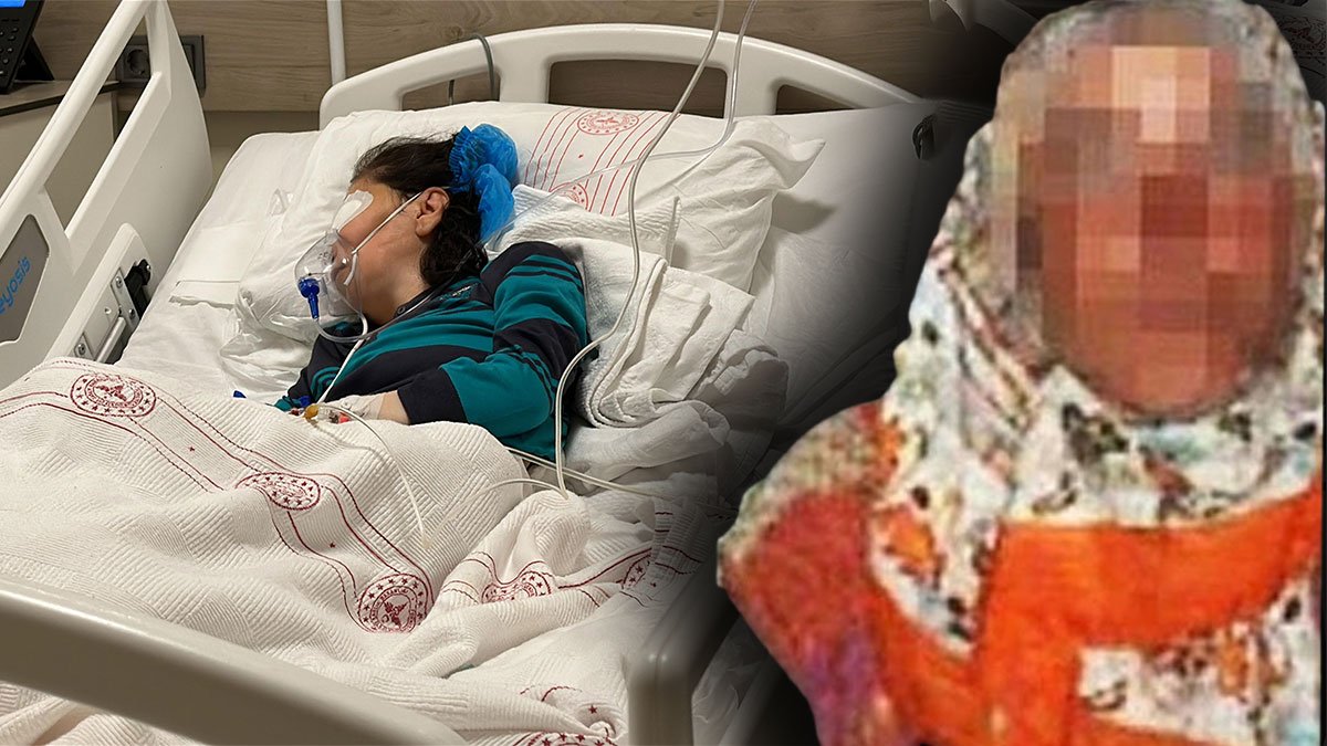 Bakım merkezinde kadının gözlerini oydu