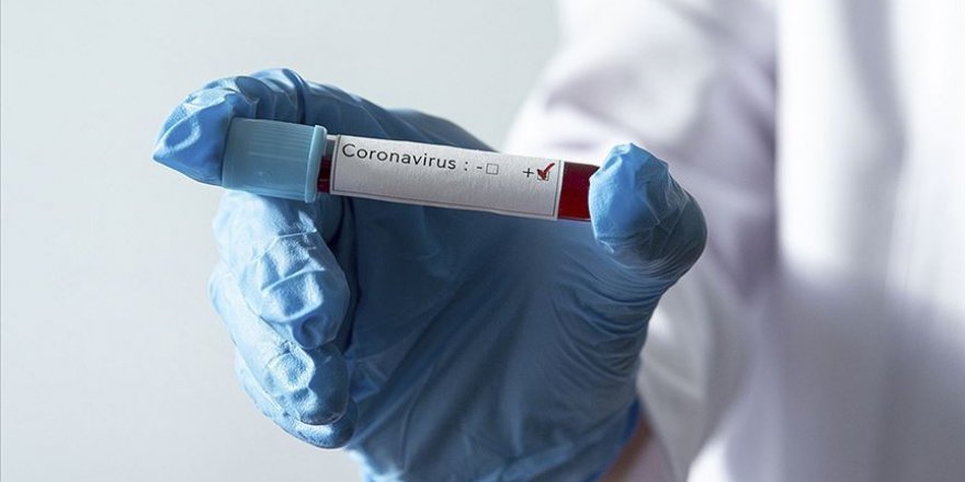 Dünya genelinde Kovid-19 vaka sayısı 1 milyon 700 bini aştı