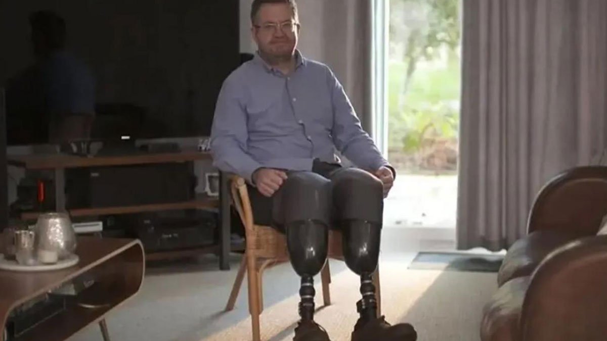 Bacaklarını kesen cerrah hayrete düşürdü!