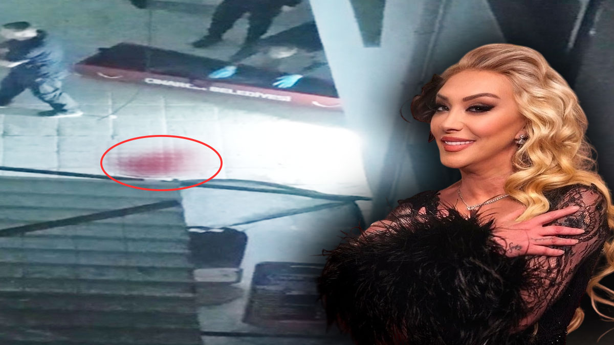 Güllü'nün otopsi raporu çıktı! Yürek burkan o detaylar