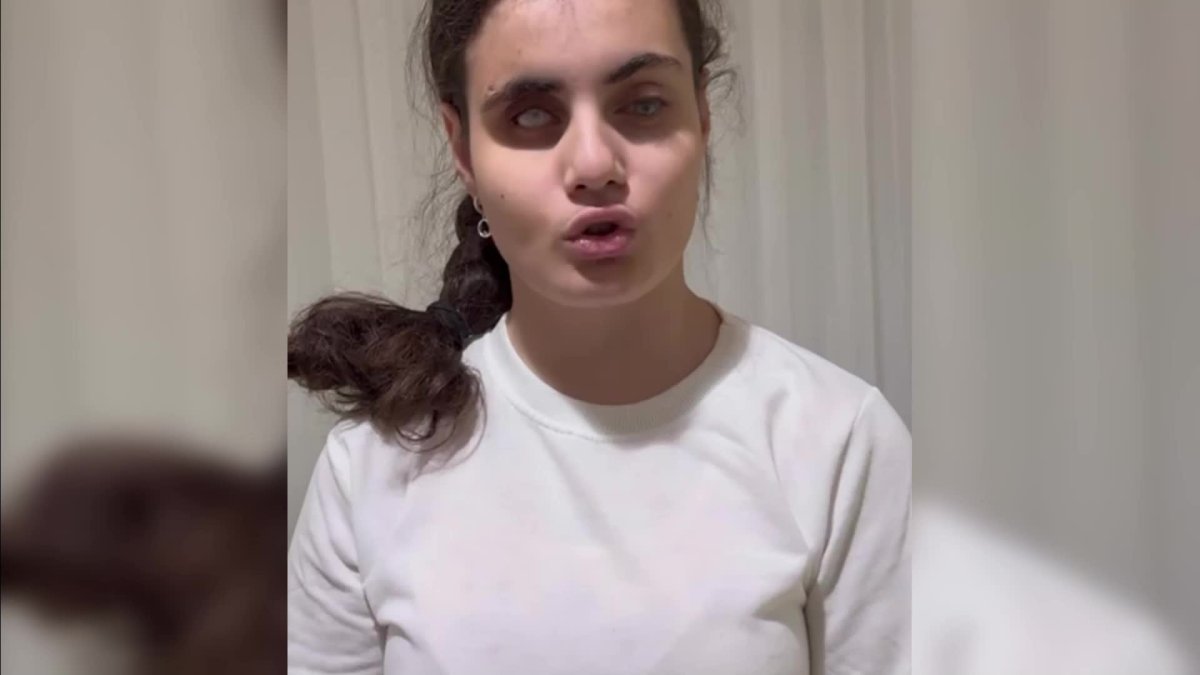 Görme engelli İmranur'un Haluk Levent'le sahne hayali