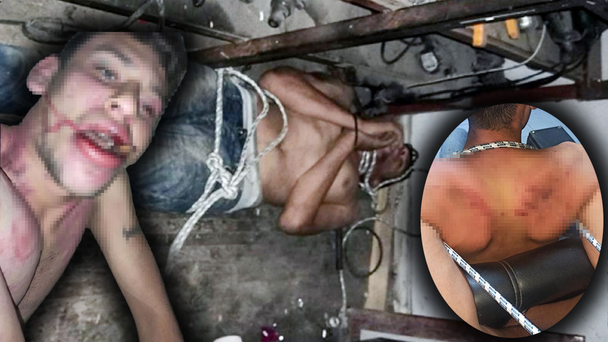 3 gün işkence gördü! Böcek yedirilip dişleri kırıldı!