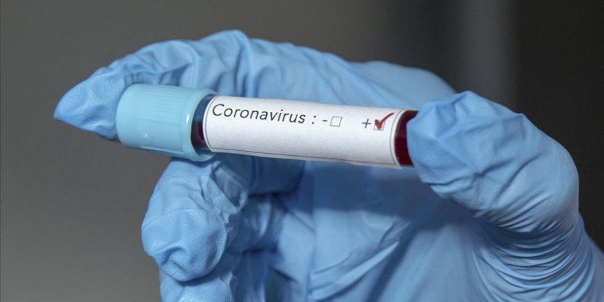 Gaziantep FK'de bir personelin Kovid-19 testi pozitif çıktı