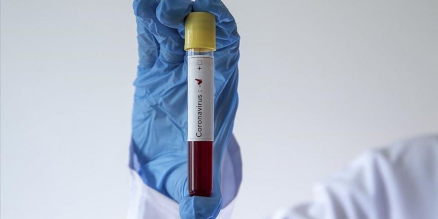 TFF hakemlerin test sonuçlarını açıkladı