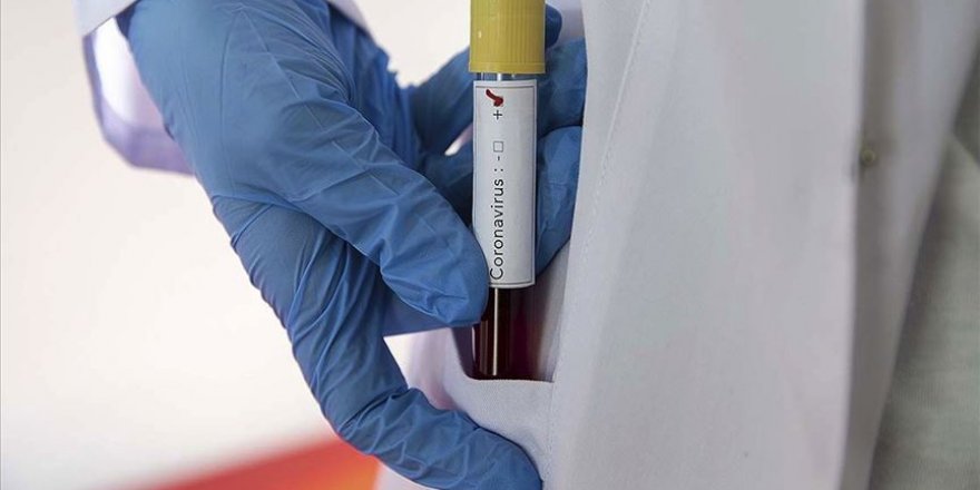 Premier Lig'in başlamasına günler kala Norwich Cityli oyuncuda koronavirüs tespit edildi