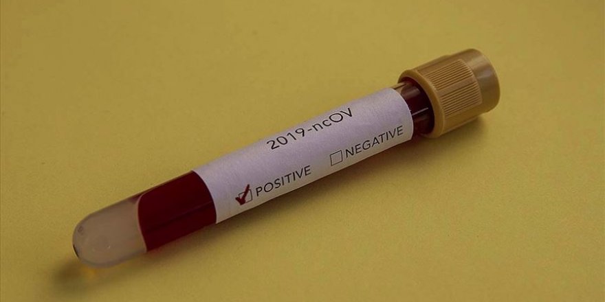 Fenerbahçe'de bir futbolcunun testi pozitif çıktı