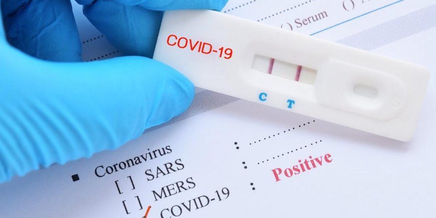 Almanya Kovid-19 test stratejisi güncellendi