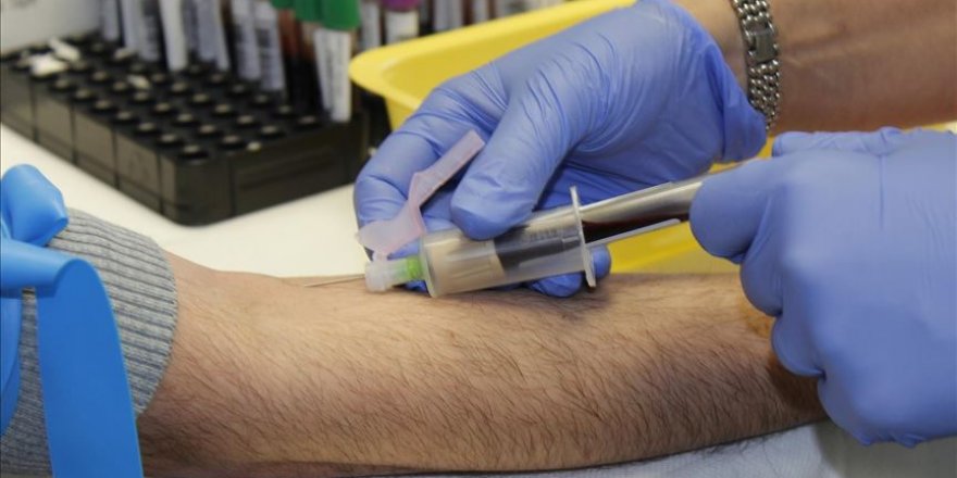 Kovid-19 damarların içinde pıhtı oluşumunu tetikliyor