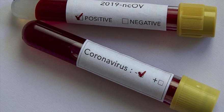 Antarktika'da ilk Kovid-19 vakaları görüldü