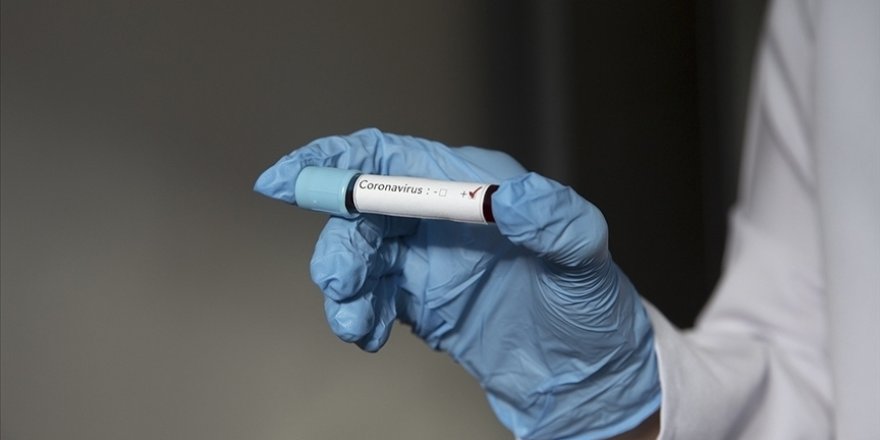 Gençlerbirliği'nde 5 kişinin Kovid-19 testi pozitif çıktı