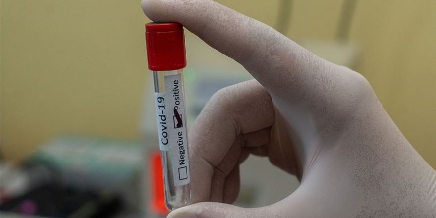 Araştırma: Kovid-19’u hafif atlatan 10 kişiden 1’inde hastalığın etkisi uzun sürüyor