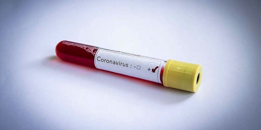 Kovid-19 tedavisinde 'hidroksiklorokin' ilacı kullanılmayacak