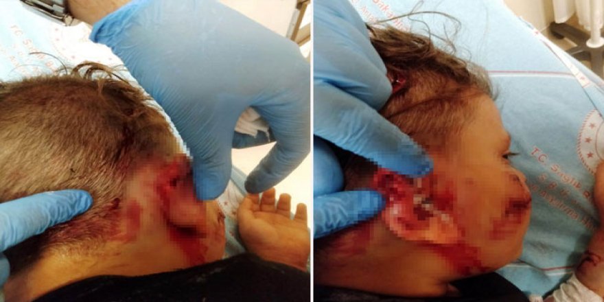 Sevmek istediği köpeğin saldırdığı küçük Yağız ölümden döndü