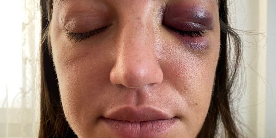 Mankene eski sevgili dehşeti