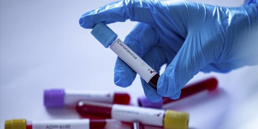 Dünya genelinde Kovid-19 vaka sayısı 200 milyonu geçti