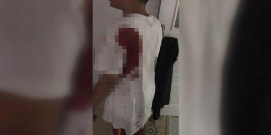 Çivi sandı yorgun mermi çıktı