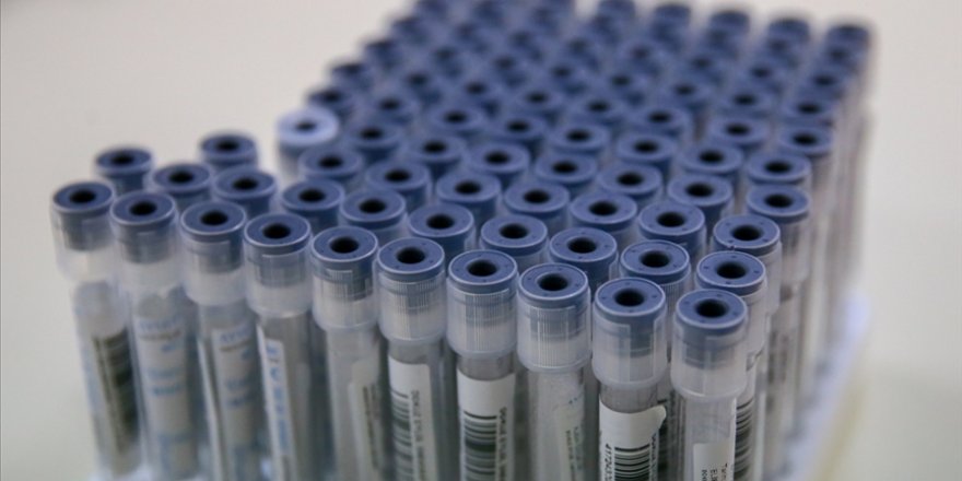 PCR testi zorunluluğu kaldırıldı