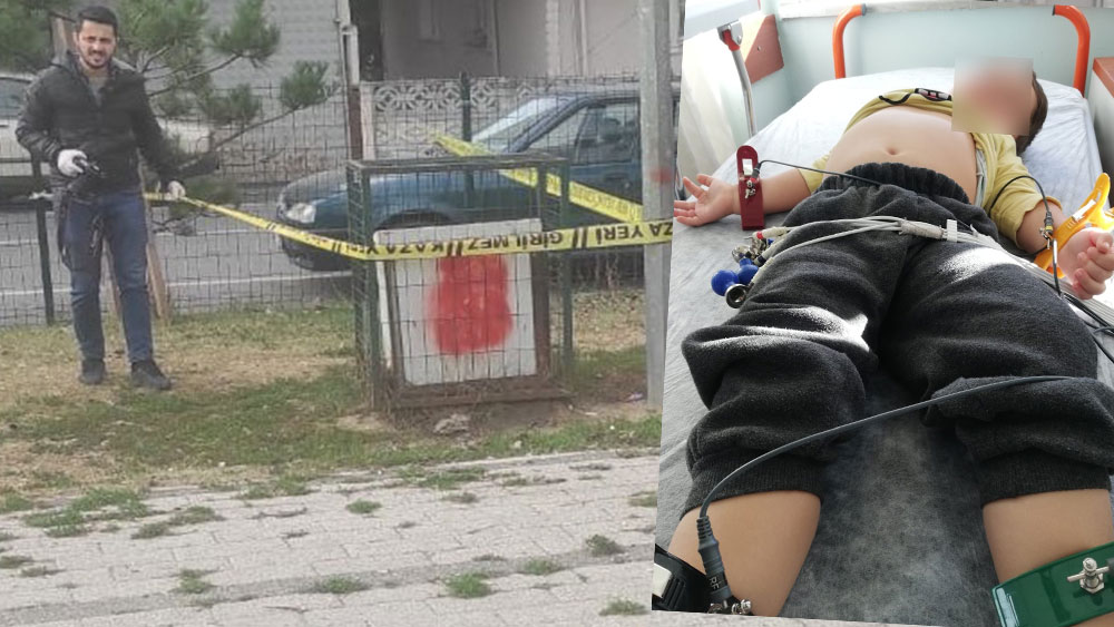 Parkta dehşet! 3 yaşındaki çocuk hemen hastaneye kaldırıldı