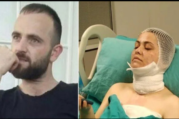 Boşandığı kadına kimyasal madde ile saldırdı