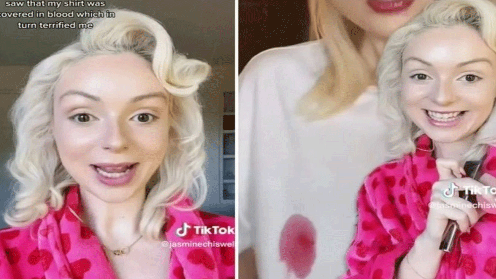 TikTok fenomeni kadının meme ucu koptu: Sosyal medyada paylaştı