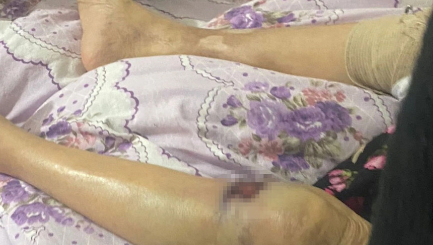 Bakıcının darp ettiği yaşlı kadın ölüm kalım savaşı veriyor