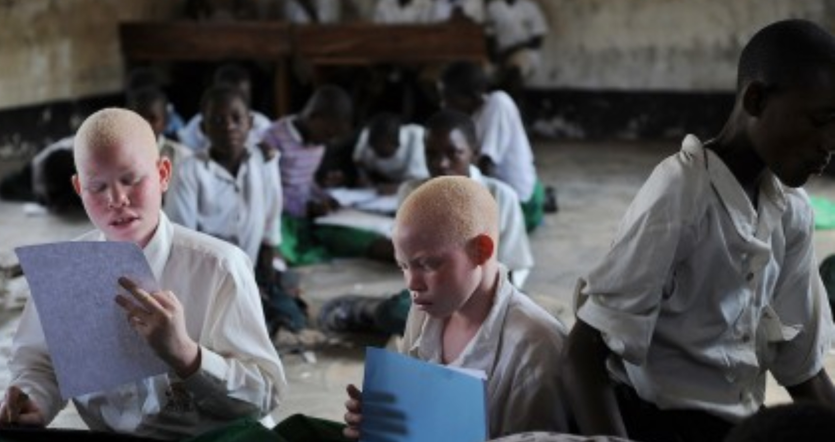 Albino adamın cesedi korunaklı mezardan çalındı