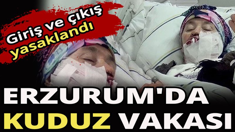 Erzurum'da kuduz vakası