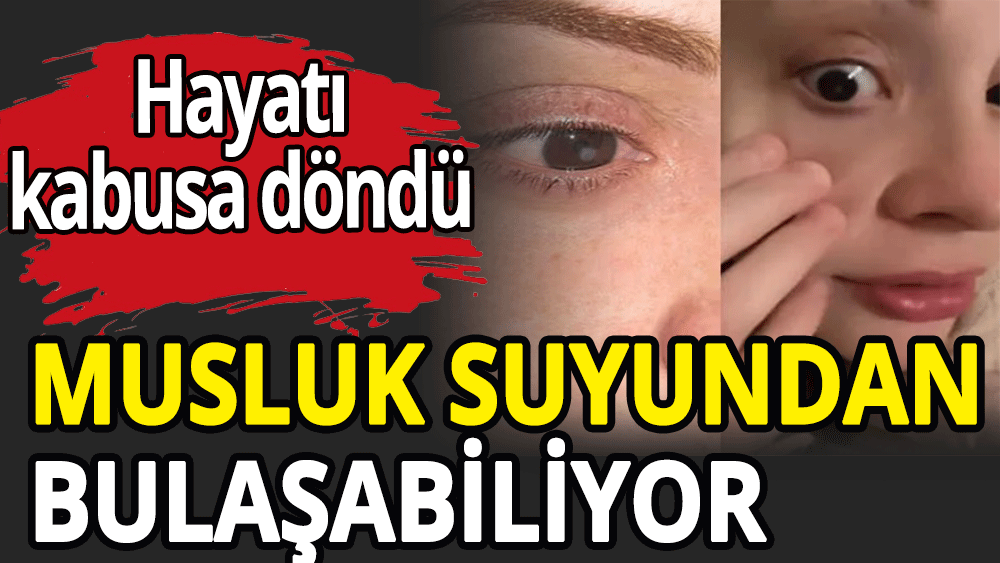 Musluk suyundan bile bulaşabiliyor