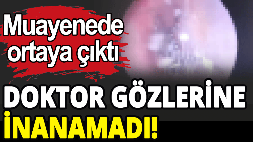 Doktor gözlerine inanamadı