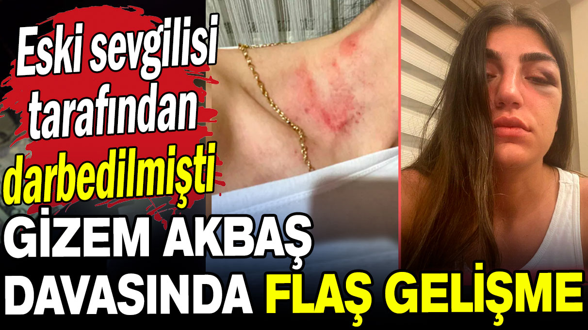 Eski sevgilisi tarafından darbedilmişti: Gizem Akbaş davasında flaş gelişme