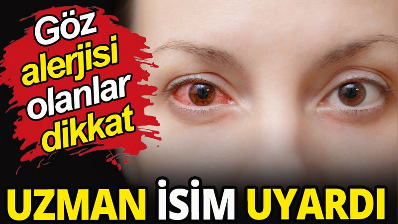 Göz alerjisi olanlar dikkat!