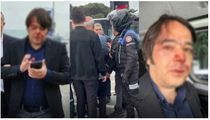 İstanbul İmar Müdürü darp edildi