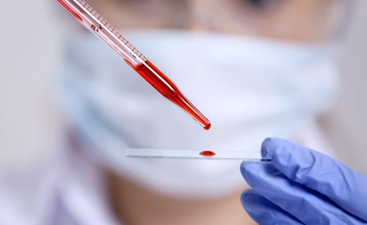 Kan testiyle her üç kanserden ikisi tespit edildi