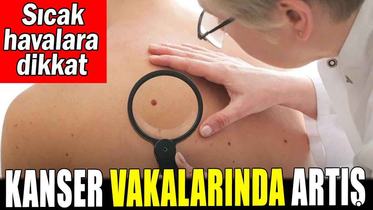 Kanser vakalarında artış