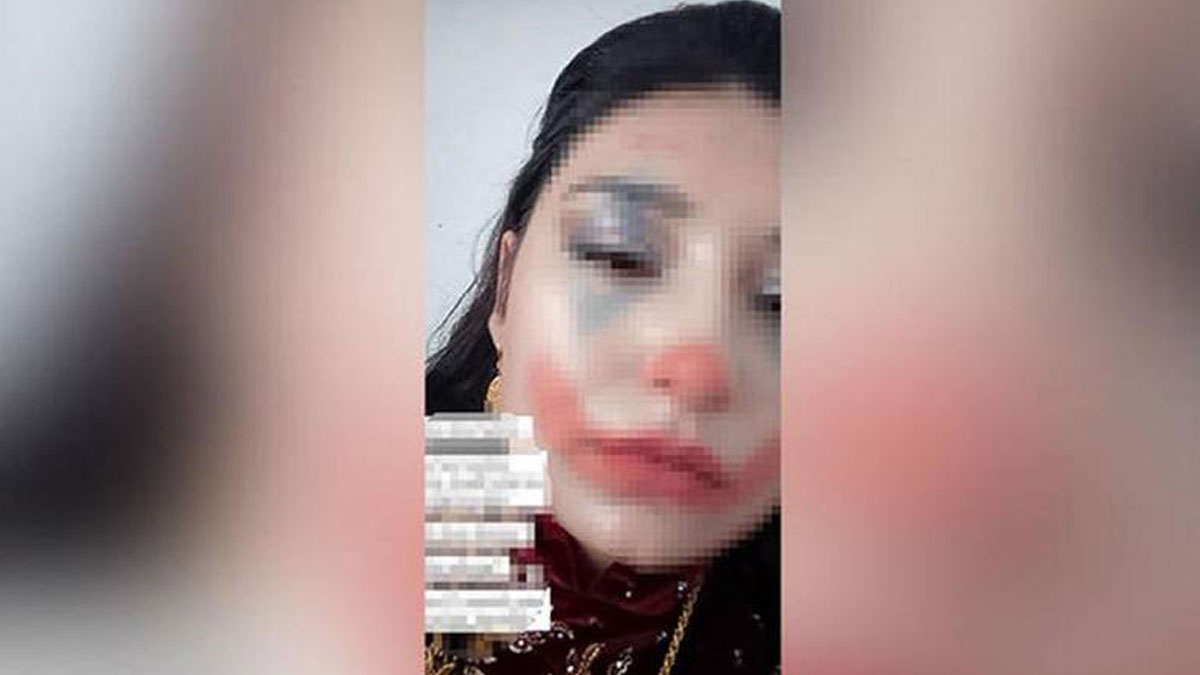 Niğde'de 15 yaşında zorla evlendirilmek istenen kız çocuğu, bakanlık tarafından koruma altına alındı