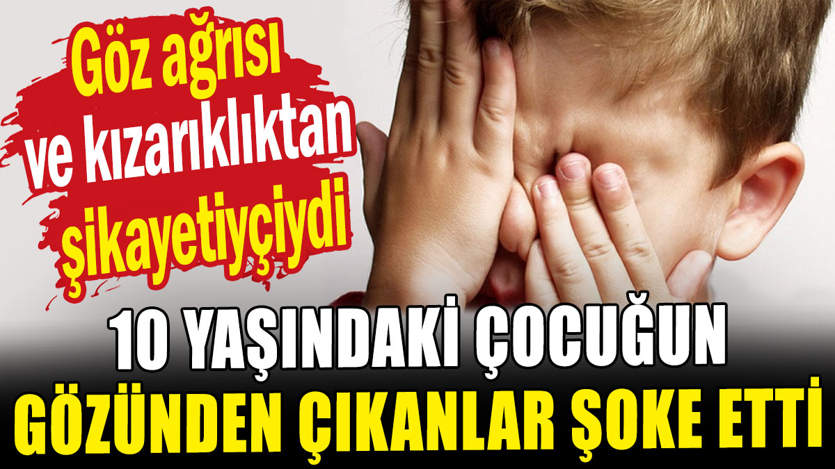 Çocuğun gözünden çıkanlar şoke etti!