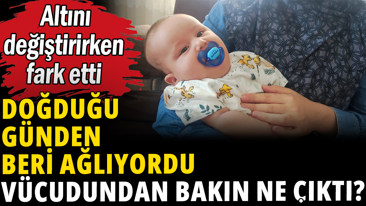 Doğduğu günden beri ağlıyordu vücudundan bakın ne çıktı?