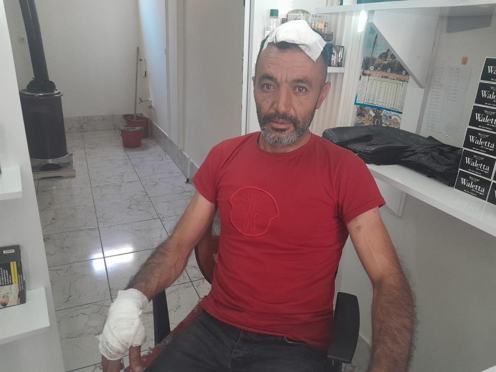 Dükkanın önünü yıkarken, başına beton düştü