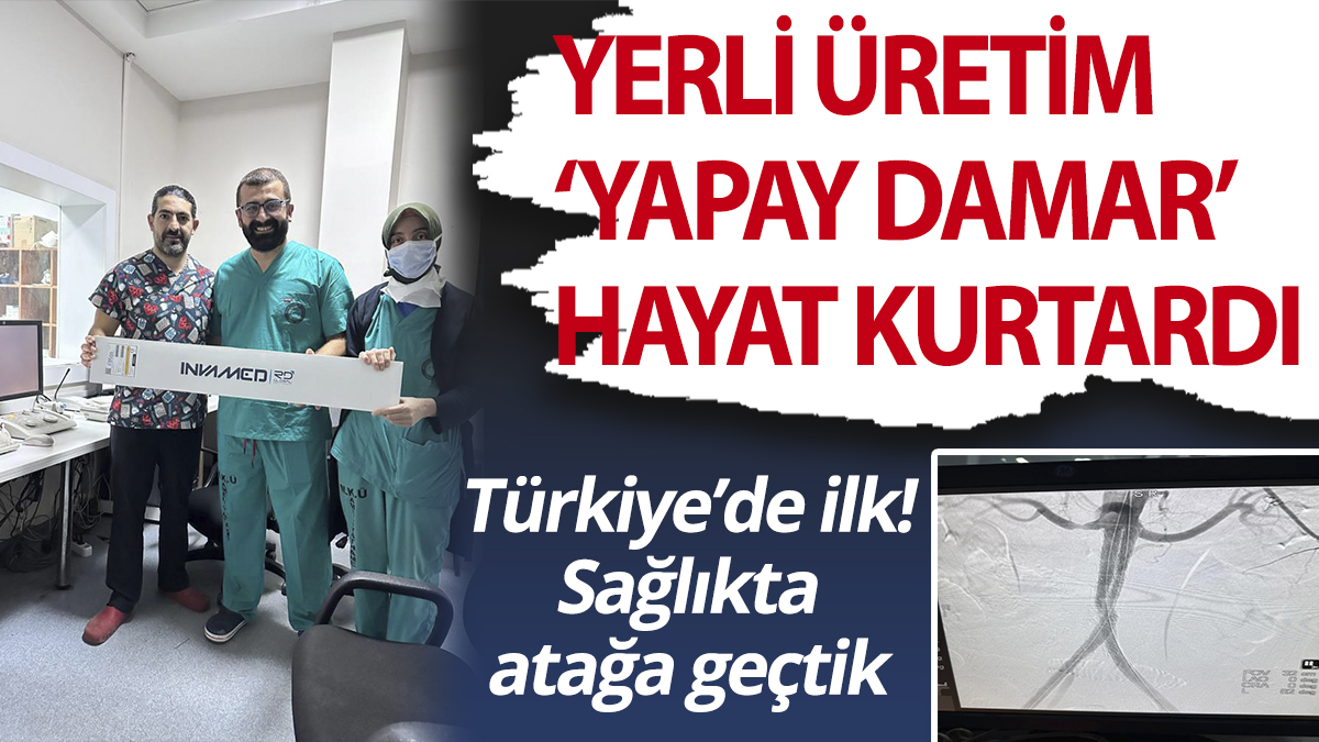 Türkiye’de ilk, Sağlıkta atağa geçtik! Yerli üretim 'yapay damar' hayat kurtardı