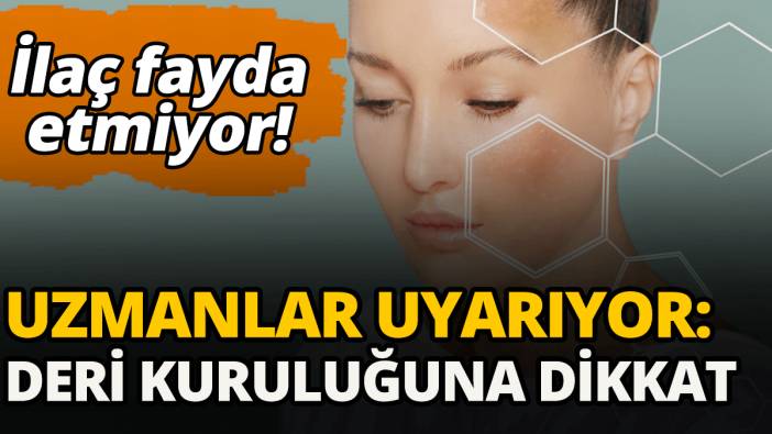 Kış aylarında sağlıklı bir cilt için bu uyarıya dikkat!