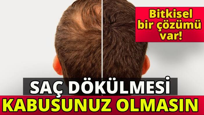 Saç dökülmesi kabusunuz olmasın 'Bitkisel bir çözümü var'