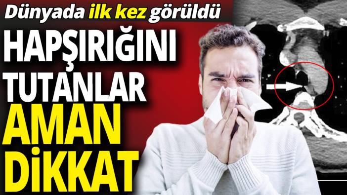 Hapşırığını tutanlar aman dikkat 'Dünyada ilk kez görüldü'