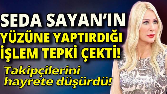Seda Sayan'ın yüzüne yaptırdığı işlem tepki çekti' Takipçilerini hayrete düşürdü'
