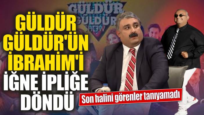 Güldür Güldür'ün İbrahim'i iğne ipliğe döndü 'Son halini görenler tanıyamadı
