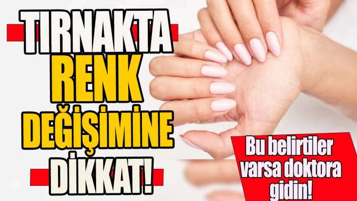 Tırnakta renk değişimine dikkat 'Bu belirtiler varsa doktora gidin'