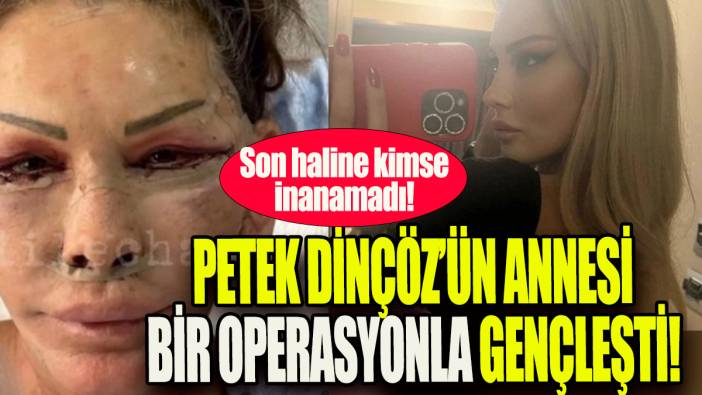 Petek Dinçöz'ün annesi bir operasyonla gençleşti: Son haline kimse inanamadı!
