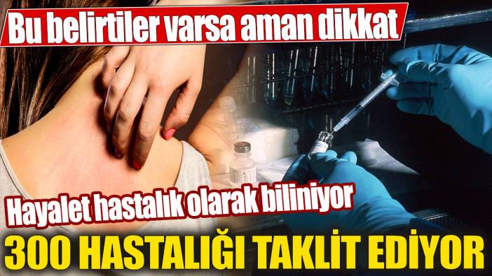 Hayalet hastalık olarak biliniyor! 300 hastalığı taklit ediyor! Bu belirtiler varsa aman dikkat