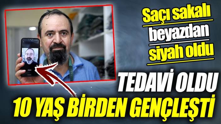 Tedavi oldu 10 yaş birden gençleşti ‘Saçı sakalı beyazdan siyah oldu’