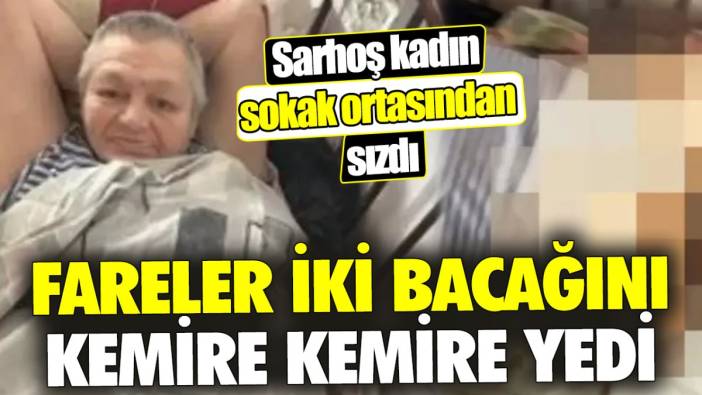 Fareler iki bacağını kemire kemire yedi ‘Sarhoş kadın sokak ortasından sızdı'