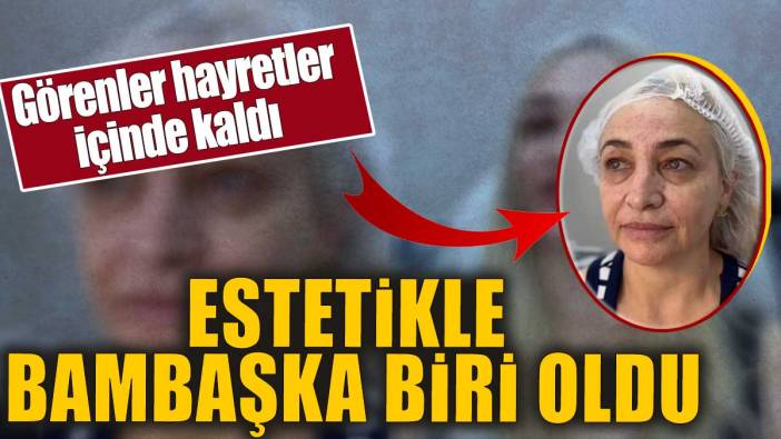 Estetikle bambaşka biri oldu. Görenler hayretler içinde kaldı